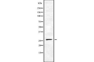 Western blot analysis of TAF9B using NIH-3T3 whole cell lysates (TAF9B antibody  (N-Term))