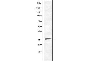 Western blot analysis of TAF9B using NIH-3T3 whole cell lysates