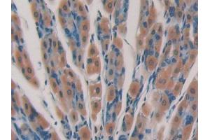 Immunohistochemistry (IHC) image for anti-DNA Fragmentation Factor, 45kDa, alpha Polypeptide (DFFA) (AA 19-262) antibody (ABIN5013466)