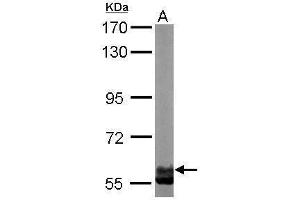 WB Image Sample (50 ug of whole cell lysate) A: Mouse brain 7. (CCT6A antibody)