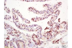 Formalin-fixed and paraffin embedded mouse intestine labeled with Rabbit Anti RNF36 Polyclonal Antibody, Unconjugated (ABIN872882) at 1:200 followed by conjugation to the secondary antibody and DAB staining