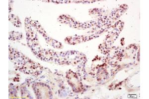 Formalin-fixed and paraffin embedded mouse intestine labeled with Rabbit Anti RNF36 Polyclonal Antibody, Unconjugated (ABIN872882) at 1:200 followed by conjugation to the secondary antibody and DAB staining (TRIM69 antibody  (AA 65-160))