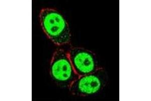 Confocal immunofluorescent analysis of SMAD3 Antibody  with Hela cell followed by Alexa Fluor 488-conjugated goat anti-rabbit lgG (green). (SMAD3 antibody  (Ser208))