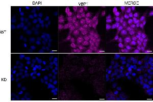 Immunocytochemical staining of HeLa cells using VBP1 antibody (ABIN7799894), 1:1,000), Top panel: wild-type (WT), Bottom panal: VBP1 shRNA knockdown (KD).