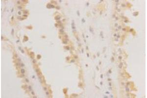 Immunohistochemistry (Paraffin-embedded Sections) (IHC (p)) image for anti-RAS (RAD and GEM)-Like GTP Binding 2 (REM2) (C-Term) antibody (ABIN1854972) (REM2 antibody  (C-Term))