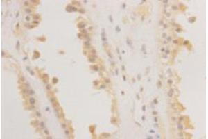 Immunohistochemistry (Paraffin-embedded Sections) (IHC (p)) image for anti-RAS (RAD and GEM)-Like GTP Binding 2 (REM2) (C-Term) antibody (ABIN1854972)
