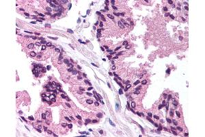 Immunohistochemistry (IHC) image for anti-Transforming Growth Factor beta 1 Induced Transcript 1 (TGFB1I1) (AA 179-228) antibody (ABIN6736433)