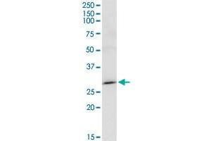 MAGEA8 MaxPab rabbit polyclonal antibody. (MAGEA8 antibody  (AA 1-318))