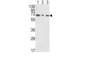 Western Blotting (WB) image for anti-Polymeric Immunoglobulin Receptor (PIGR) antibody (ABIN3003801) (PIGR antibody)