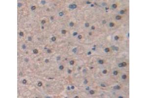 Figure. (HIST1H2AJ antibody  (AA 1-128))