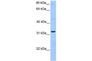 ATG5 antibody used at 1 ug/ml to detect target protein. (ATG5 antibody)