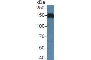 Western blot analysis of Human Raji cell lysate, using Human CR2 Antibody (5 µg/ml) and HRP-conjugated Goat Anti-Rabbit antibody (