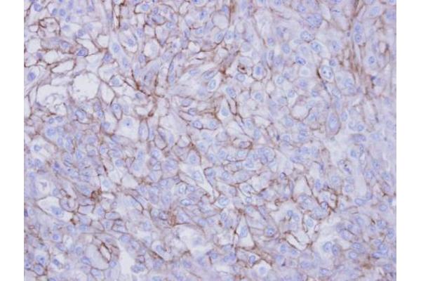Desmoglein 2 antibody  (N-Term)