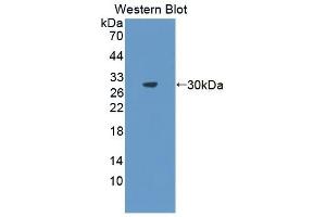 Detection of Recombinant ABCB5, Human using Polyclonal Antibody to ATP Binding Cassette Transporter B5 (ABCB5) (ABCB5 antibody  (AA 570-808))