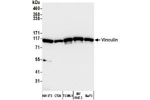 anti-Vinculin (VCL) (AA 1016-1066) antibody