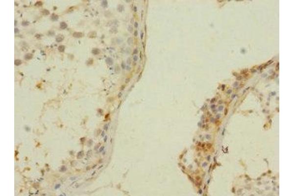 ZNF564 antibody  (AA 1-200)