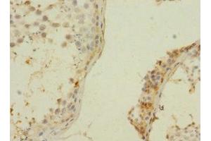 Immunohistochemistry of paraffin-embedded human testis tissue using ABIN7176393 at dilution of 1:100 (ZNF564 antibody  (AA 1-200))