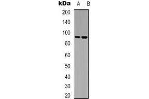 Western blot analysis of LTK expression in Raji (A), Jurkat (B) whole cell lysates.
