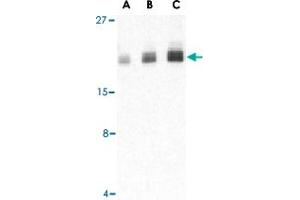 Western blot analysis of PTRH2 in Daudi cell lysate with PTRH2 polyclonal antibody  at (A) 1, (B) 2, and (C) 4 ug/mL .