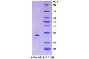 SDS-PAGE (SDS) image for Hemoglobin, alpha 1 (HBA1) (AA 1-142) protein (His tag) (ABIN1170610)