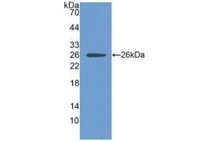Detection of Recombinant CLIC1, Human using Polyclonal Antibody to Chloride Intracellular Channel Protein 1 (CLIC1) (CLIC1 antibody  (AA 79-241))