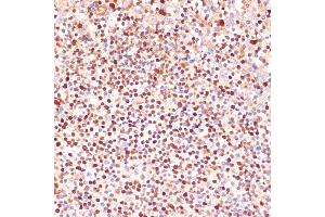 Immunohistochemistry of paraffin-embedded human tonsil using  antibody (ABIN3023072, ABIN3023073, ABIN3023074 and ABIN6219376) at dilution of 1:100 (40x lens). (ALOX5 antibody  (AA 1-300))