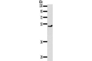 Gel: 10 % SDS-PAGE, Lysate: 40 μg, Lane: Mouse heart tissue, Primary antibody: ABIN7191971(PPARD Antibody) at dilution 1/500, Secondary antibody: Goat anti rabbit IgG at 1/8000 dilution, Exposure time: 30 seconds (PPARD antibody)