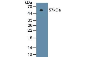 Detection of Recombinant ITGb1, Human using Monoclonal Antibody to Integrin Beta 1 (ITGb1) (ITGB1 antibody  (AA 140-383))