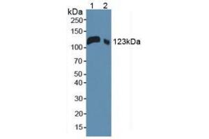 Western blot analysis of (1) Mouse Serum and (2) Mouse Placenta Tissue. (LIFR antibody  (AA 381-485))