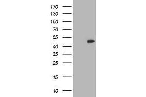 HEK293T cells were transfected with the pCMV6-ENTRY control (Left lane) or pCMV6-ENTRY CCM2 (Right lane) cDNA for 48 hrs and lysed. (CCM2 antibody)