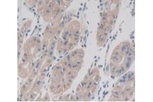 Detection of TMEM27 in Human Stomach Tissue using Monoclonal Antibody to Transmembrane Protein 27 (TMEM27) (TMEM27 antibody  (AA 17-137))