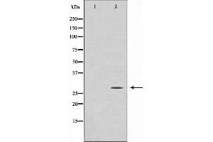 Western blot analysis on Jurkat cell lysate using GADD153 Antibody,The lane on the left is treated with the antigen-specific peptide. (DDIT3 antibody  (N-Term))