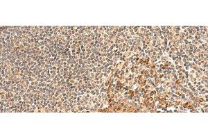 Immunohistochemistry of paraffin-embedded Human tonsil tissue using GALNT12 Polyclonal Antibody at dilution of 1:60(x200) (GALNT12 antibody)