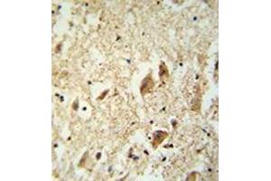 Immunohistochemistry analysis in formalin fixed and paraffin embedded human brain tissue reacted with KATNAL1 Antibody (N-term) followed which was peroxidase conjugated to the secondary antibody and followed by DAB staining. (KATNAL1 antibody  (N-Term))