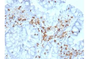 Formalin-fixed, paraffin-embedded human Colon stained with CD103 Mouse Monoclonal Antibody (ITGAE/2063). (CD103 antibody)