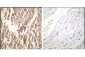 Immunohistochemistry analysis of paraffin-embedded human heart, using TNNI3 (Phospho-Ser43) Antibody. (TNNI3 antibody  (pSer43))