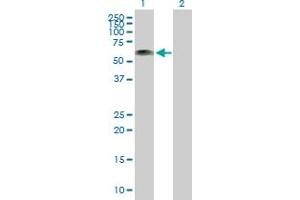 Western Blot analysis of RP1-21O18. (Kazrin antibody  (AA 1-415))