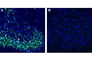 Expression of C3aR1 in rat spinal cord. (C3AR1 antibody  (Extracellular))
