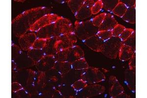 IF analysis of Desmin using anti-Desmin antibody (ABIN3043265).