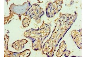 Immunohistochemistry of paraffin-embedded human placenta tissue using ABIN7170623 at dilution of 1:100 (SF3B3 antibody  (AA 948-1217))