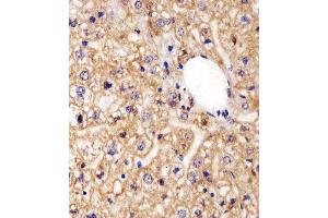 Immunohistochemistry (Paraffin-embedded Sections) (IHC (p)) image for anti-ArfGAP with GTPase Domain, Ankyrin Repeat and PH Domain 4 (AGAP4) (AA 498-531), (C-Term) antibody (ABIN1944739)