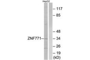 Western blot analysis of extracts from HepG2 cells, using ZNF771 Antibody. (ZNF771 antibody  (AA 161-210))