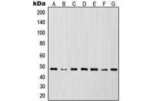 Western blot analysis of IKK gamma expression in Jurkat (A), HL60 (B), HeLa (C), NIH3T3 (D), Raw264. (IKBKG antibody  (Center))