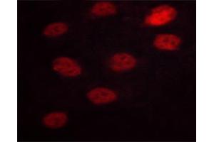 ABIN6267629 staining HeLa cells by ICC/IF.