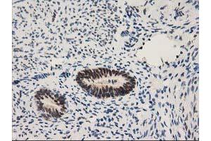 Image no. 10 for anti-Nonhomologous End-Joining Factor 1 (NHEJ1) antibody (ABIN1499729) (NHEJ1 antibody)