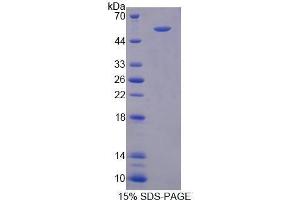 SDS-PAGE (SDS) image for Podocalyxin-Like (PODXL) (AA 220-431) protein (His tag,GST tag) (ABIN2123490) (PODXL Protein (AA 220-431) (His tag,GST tag))