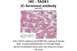 Image no. 2 for anti-TAO Kinase 1 (TAOK1) (C-Term) antibody (ABIN1739898) (TAO Kinase 1 (TAOK1) (C-Term) antibody)