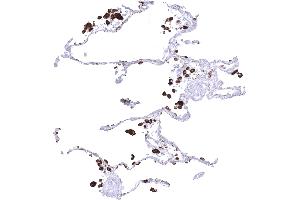 Normal lung showing strong Napsin A immunostaining of pneumocytes and alveolar macrophages (Recombinant NAPSA antibody  (AA 189-299))