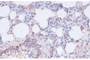 Immunohistochemistry of paraffin-embedded Rat lung using VASP Polyclonal Antibody at dilution of 1:100 (40x lens).