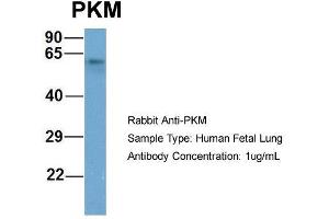 Host: Rabbit  Target Name: PKM  Sample Tissue: Human Fetal Lung  Antibody Dilution: 1. (PKM2 antibody  (Middle Region))